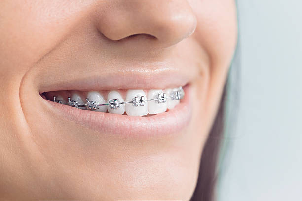 Best Teeth Whitening  in Eden, TX